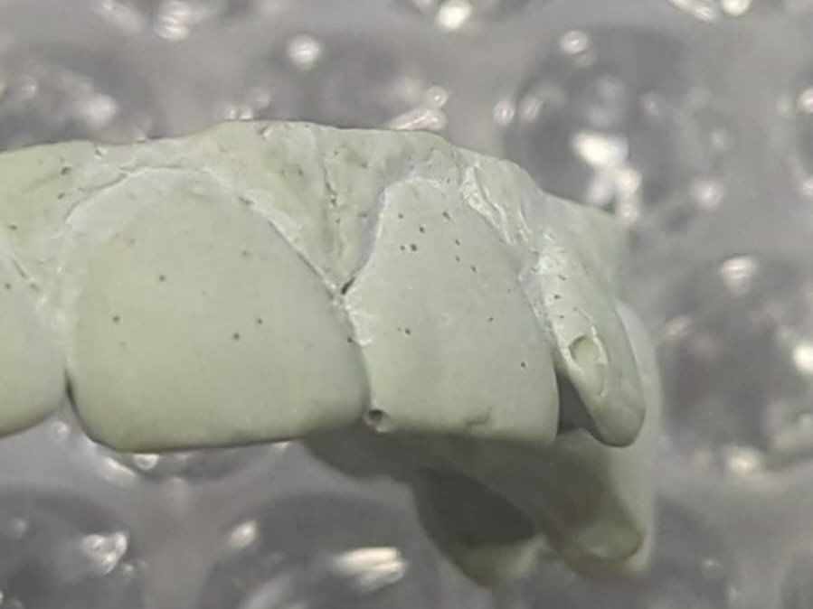 Close-up of the model's front teeth with each tooth edge hand-detailed