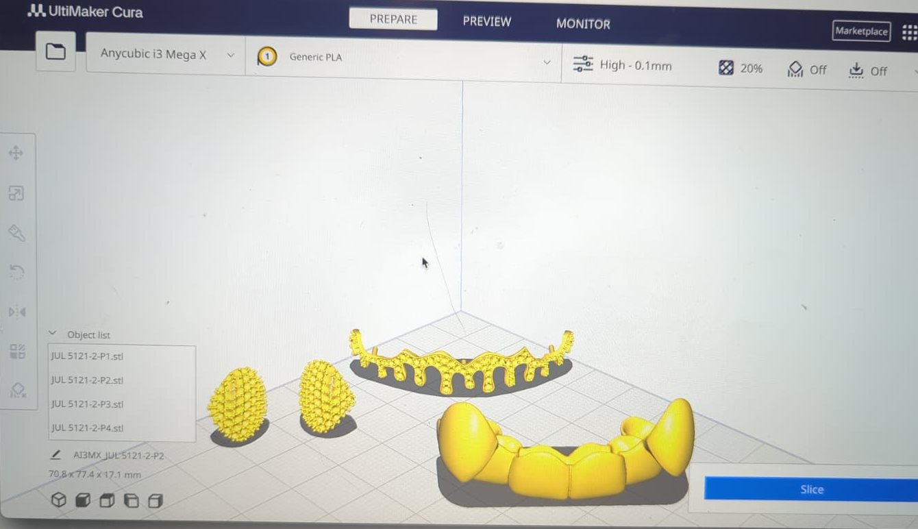 The set split into four parts and prepared for a high-detail plastic print at 0.1–0.13 mm layers, for the fit test