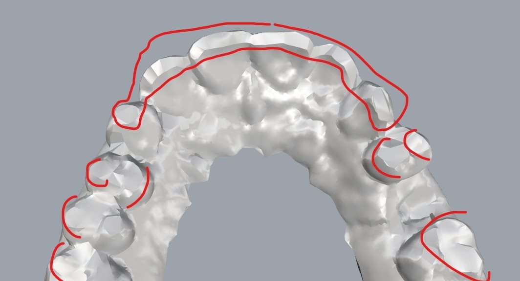 3D scan of a customer's dental mold seen from above, with each tooth edge traced in red