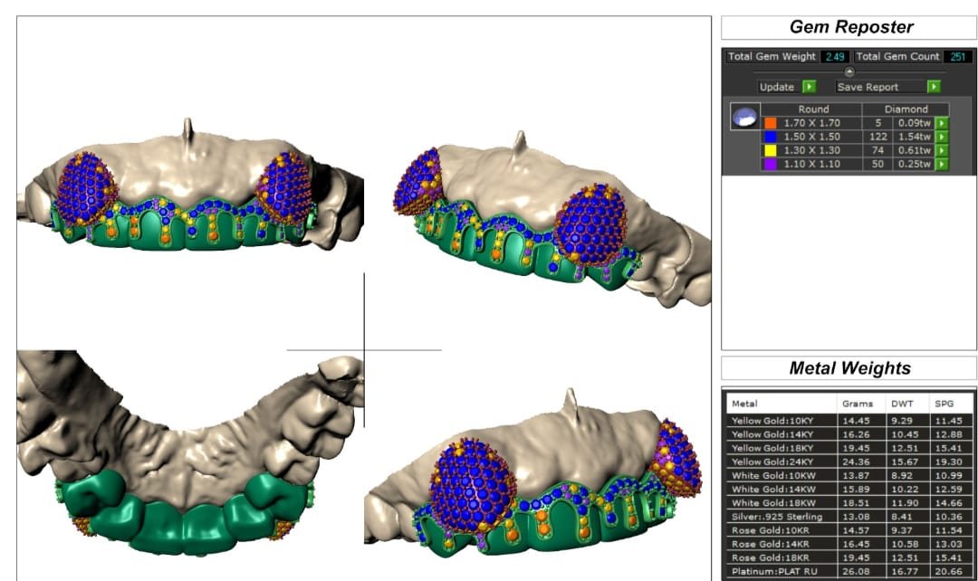 CAD design of the set on the scanned mold from four angles, with a gem report listing 251 stones in four sizes and the metal weight for each gold karat, silver and platinum