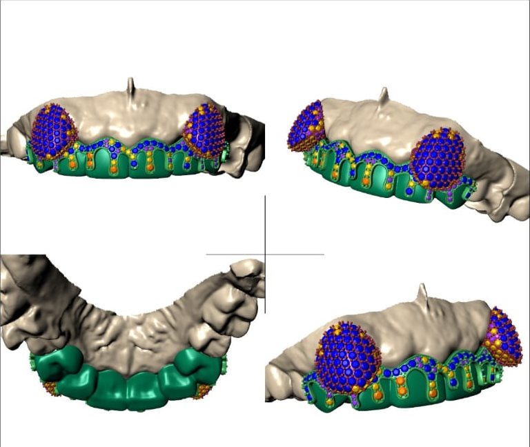 CAD design preview: stone mosaic planned across a drip-style grill with pavé canines, shown from four angles