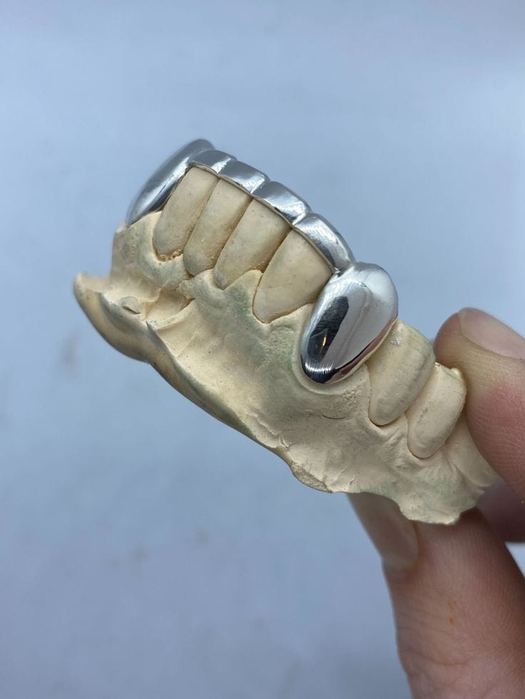 Design preview: open-face grill shown on a dental model